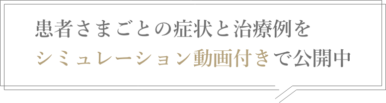 患者さまごとの症状と治療例をシミュレーション動画付きで公開中